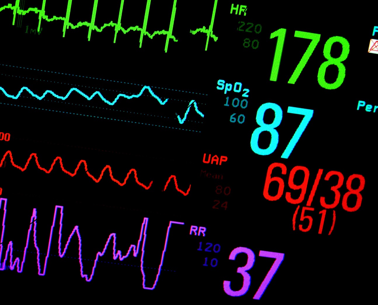 How Is Mean Arterial Pressure Map Calculator