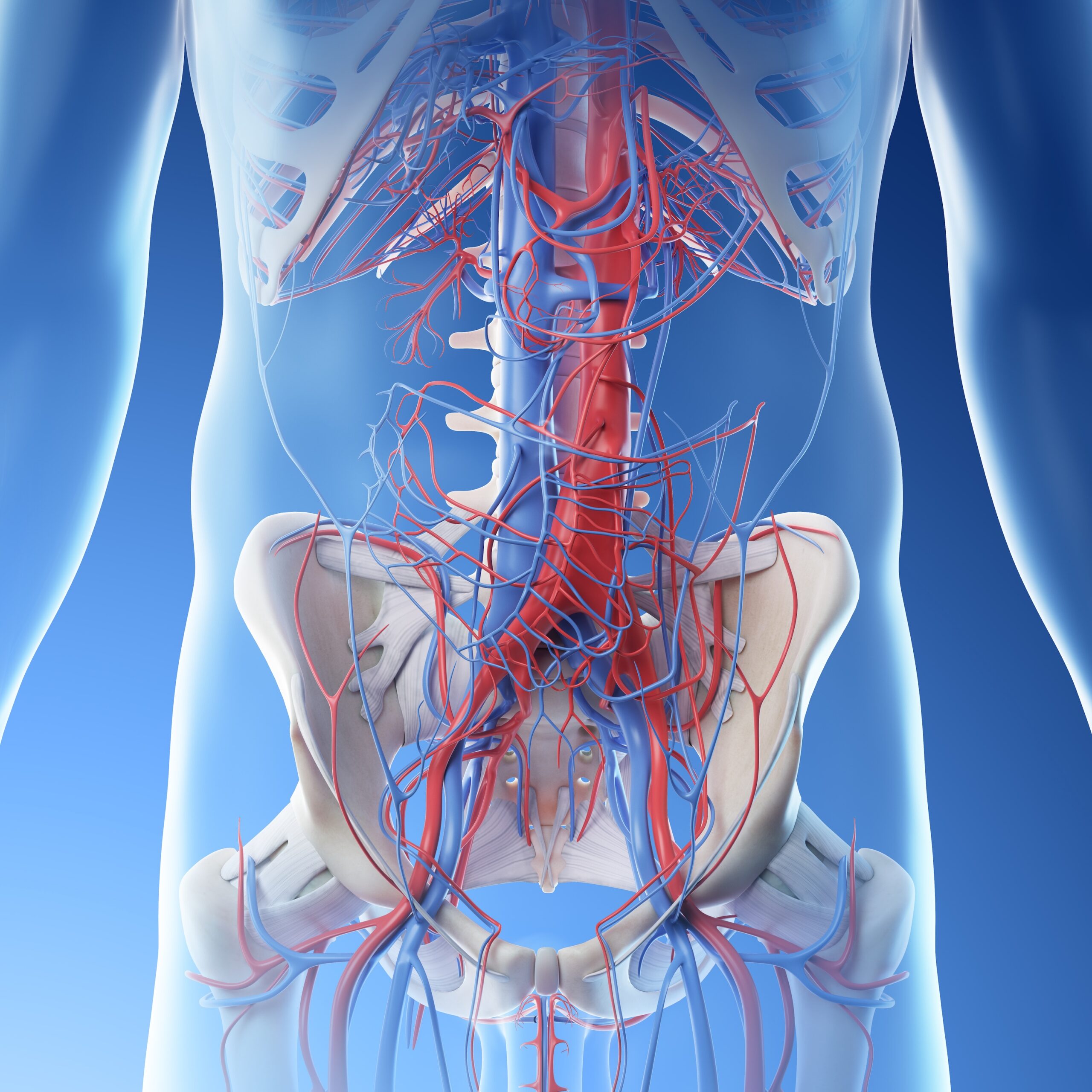 Acute Mesenteric Ischemia - EB Medicine